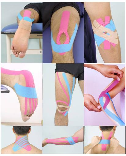 Kinesio Bantlama